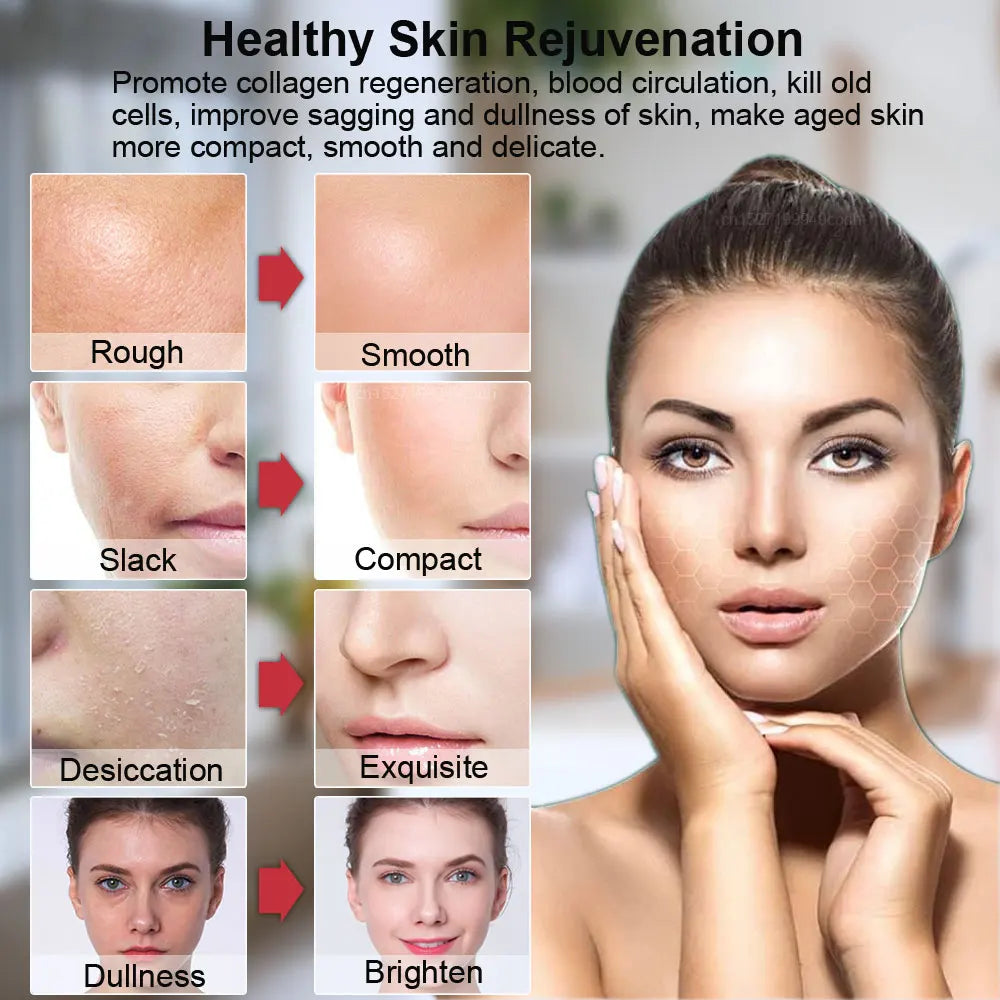 Aparelho Facial Rejuvenescimento e Firmeza da Pele